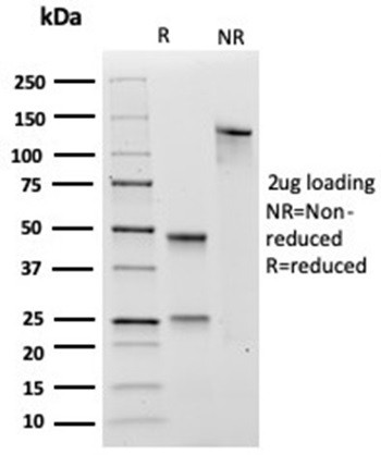 SOX4 (Master Regulator of Epithelial-Mesenchymal Transition) Antibody in SDS-PAGE (SDS-PAGE)