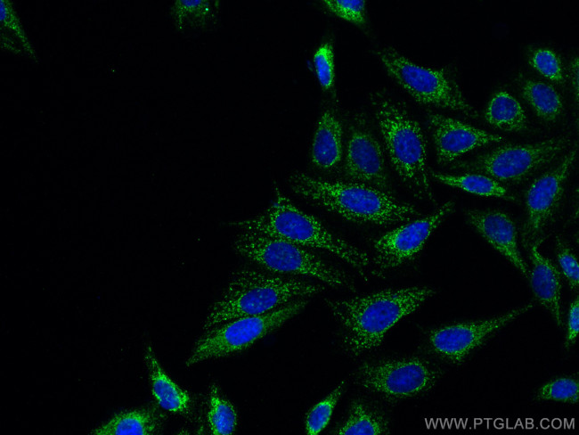 ATPB Antibody in Immunocytochemistry (ICC/IF)