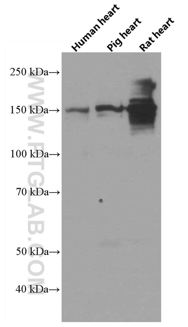 PALLD/palladin Antibody in Western Blot (WB)