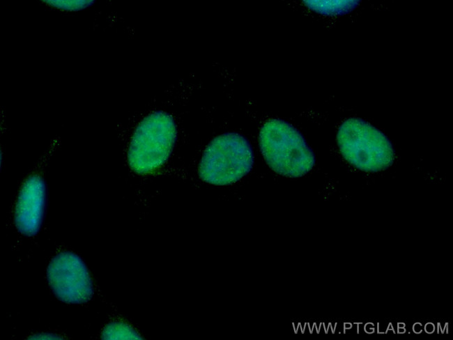 KU70/XRCC6 Antibody in Immunocytochemistry (ICC/IF)