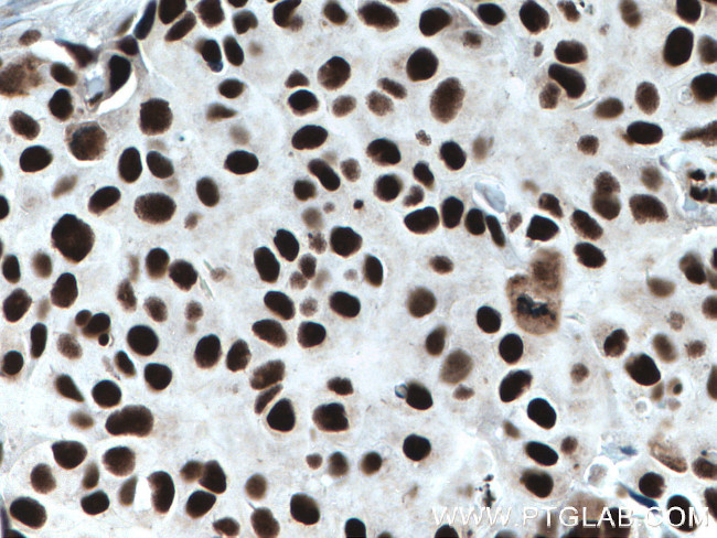 KU70/XRCC6 Antibody in Immunohistochemistry (Paraffin) (IHC (P))