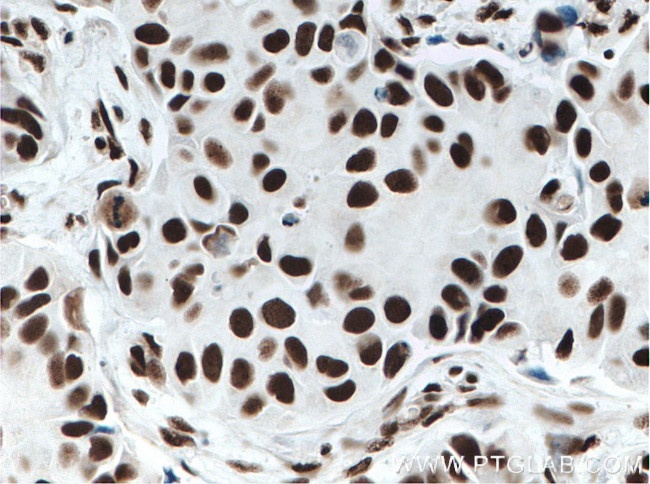 KU70/XRCC6 Antibody in Immunohistochemistry (Paraffin) (IHC (P))