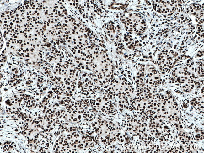 KU70/XRCC6 Antibody in Immunohistochemistry (Paraffin) (IHC (P))