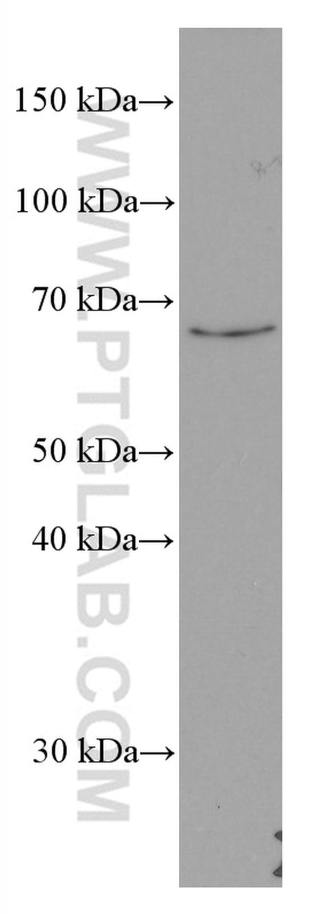 KU70/XRCC6 Antibody in Western Blot (WB)