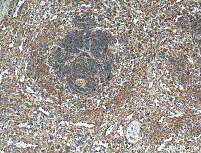 CCRL2 Antibody in Immunohistochemistry (Paraffin) (IHC (P))