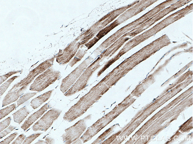 PC Antibody in Immunohistochemistry (Paraffin) (IHC (P))