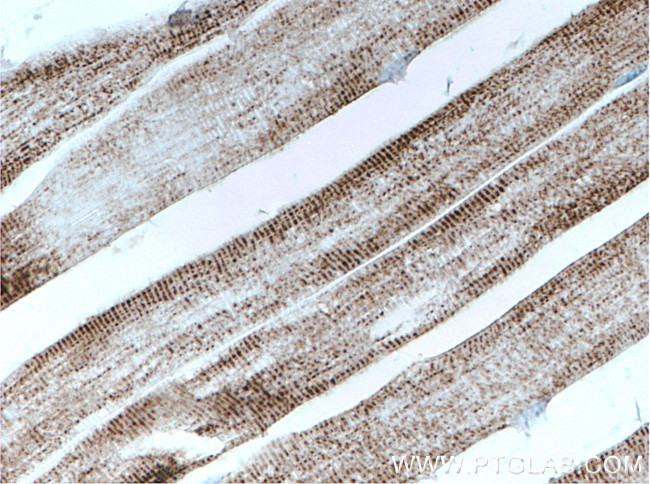 PC Antibody in Immunohistochemistry (Paraffin) (IHC (P))