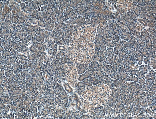 RIC8A Antibody in Immunohistochemistry (Paraffin) (IHC (P))