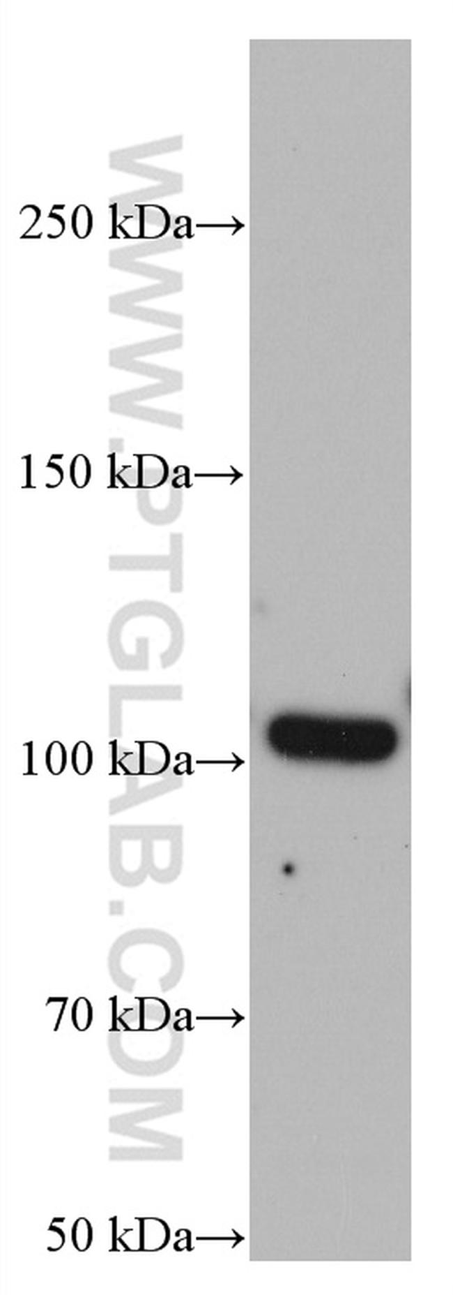 GRIK2 Antibody in Western Blot (WB)