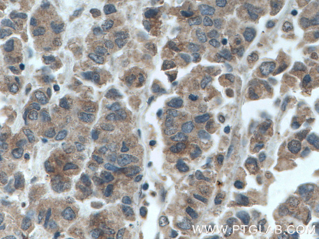 GRASP65/GORASP1 Antibody in Immunohistochemistry (Paraffin) (IHC (P))