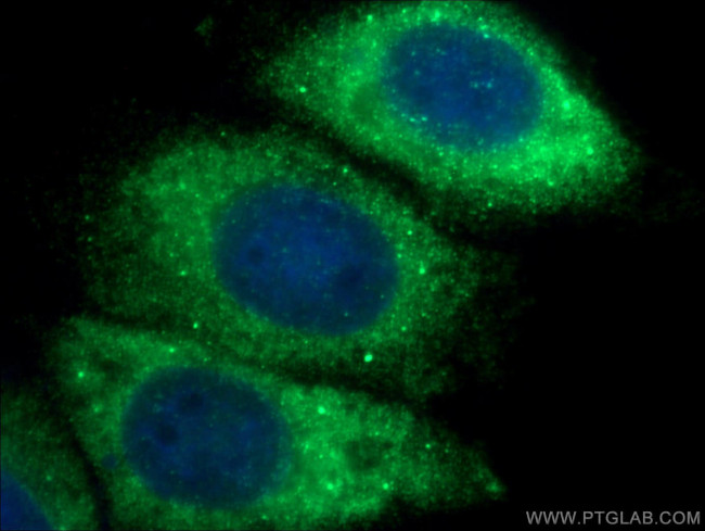 EIF4E Antibody in Immunocytochemistry (ICC/IF)