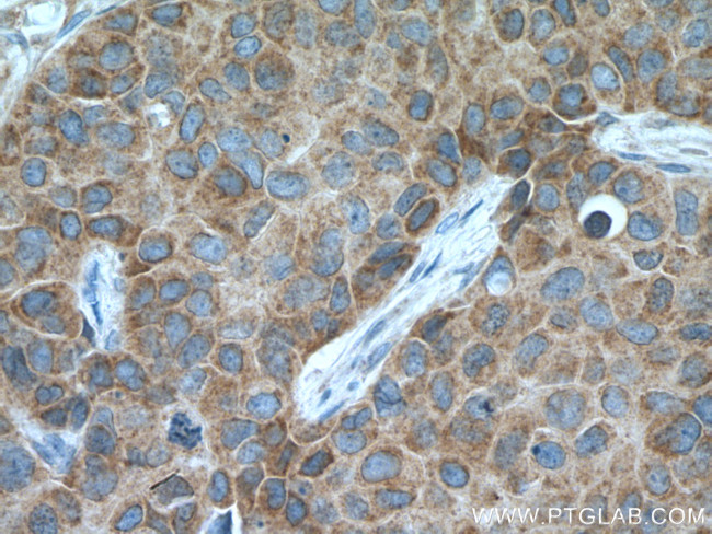 EIF4E Antibody in Immunohistochemistry (Paraffin) (IHC (P))