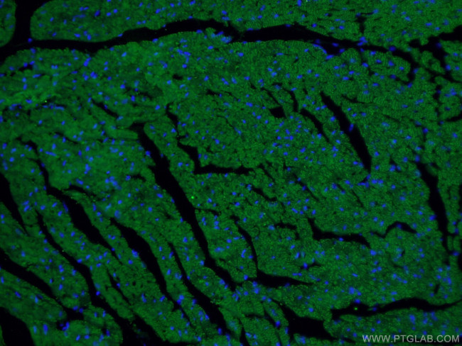 Beclin 1 Antibody in Immunohistochemistry (PFA fixed) (IHC (PFA))