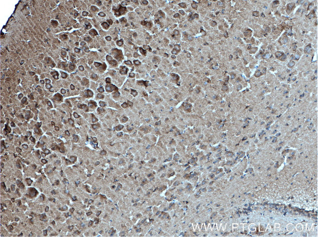 PARK2/Parkin Antibody in Immunohistochemistry (Paraffin) (IHC (P))