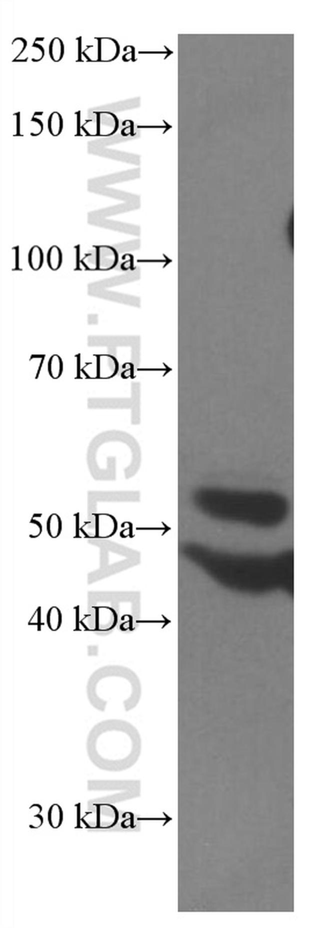 PARK2/Parkin Antibody in Western Blot (WB)