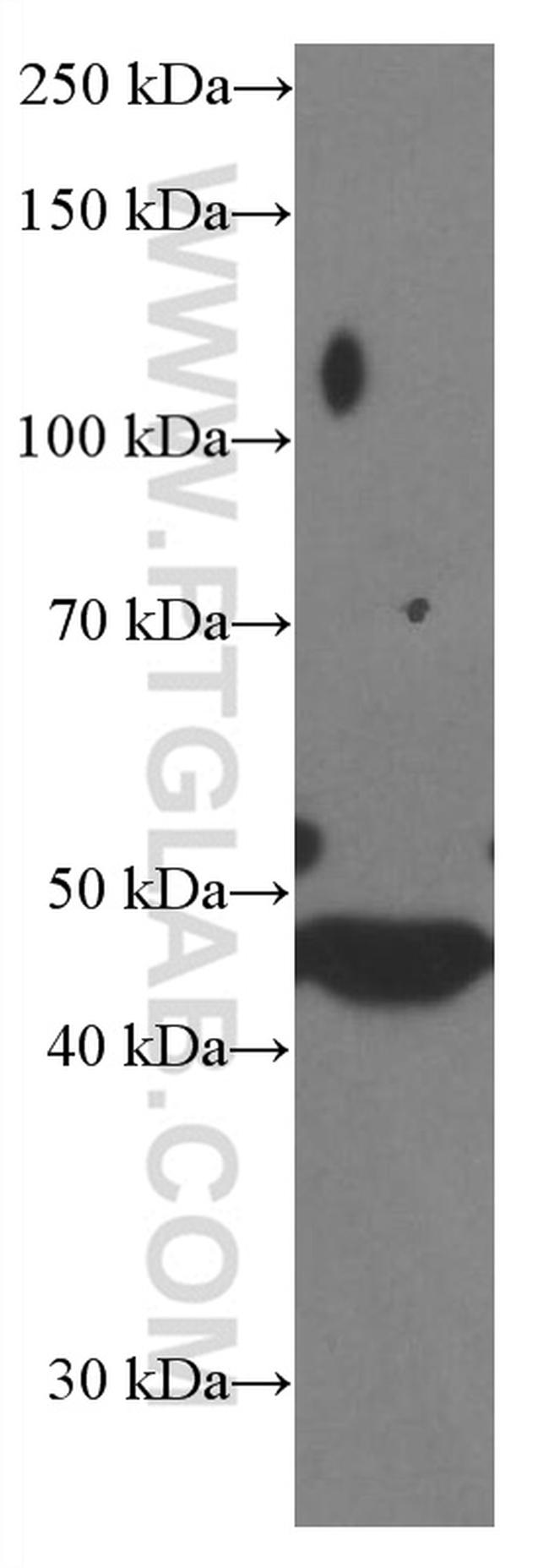 PARK2/Parkin Antibody in Western Blot (WB)