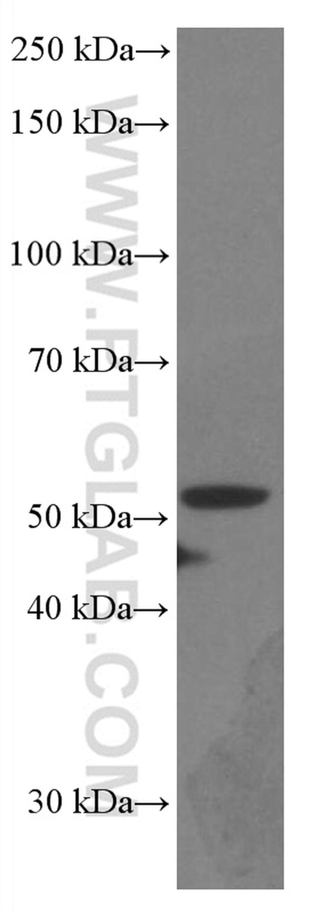 PARK2/Parkin Antibody in Western Blot (WB)