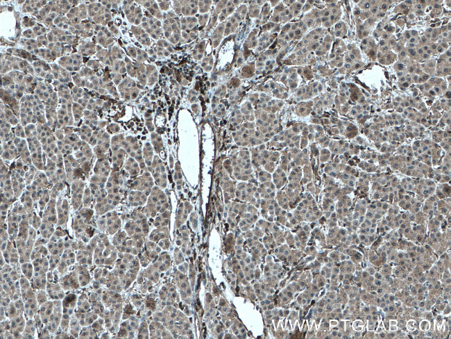 MLKL Antibody in Immunohistochemistry (Paraffin) (IHC (P))