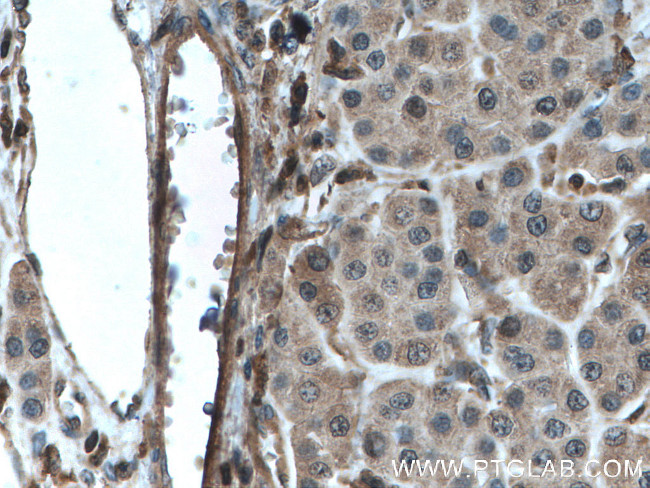 MLKL Antibody in Immunohistochemistry (Paraffin) (IHC (P))