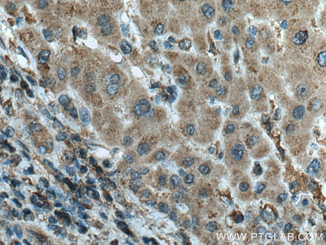 MLKL Antibody in Immunohistochemistry (Paraffin) (IHC (P))