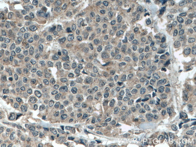 MLKL Antibody in Immunohistochemistry (Paraffin) (IHC (P))