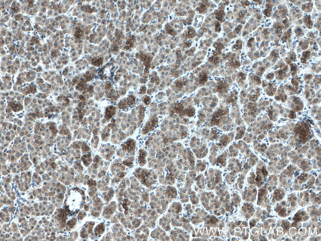 AKR7A2 Antibody in Immunohistochemistry (Paraffin) (IHC (P))