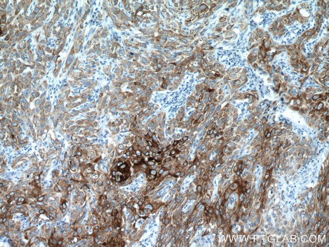 Cytokeratin 13 Antibody in Immunohistochemistry (Paraffin) (IHC (P))