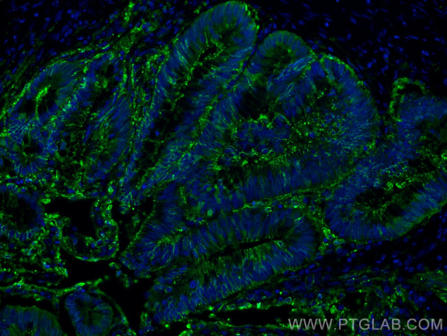 Galectin-4 Antibody in Immunohistochemistry (PFA fixed) (IHC (PFA))