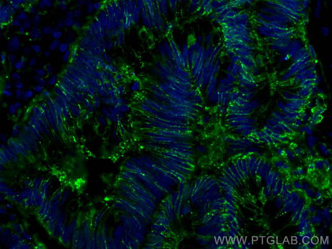 Galectin-4 Antibody in Immunohistochemistry (PFA fixed) (IHC (PFA))