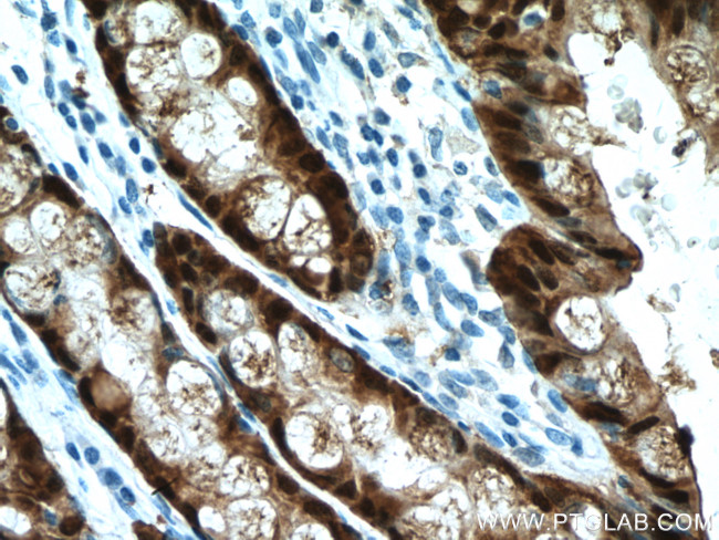 Galectin-4 Antibody in Immunohistochemistry (Paraffin) (IHC (P))