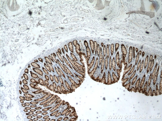 Galectin-4 Antibody in Immunohistochemistry (Paraffin) (IHC (P))