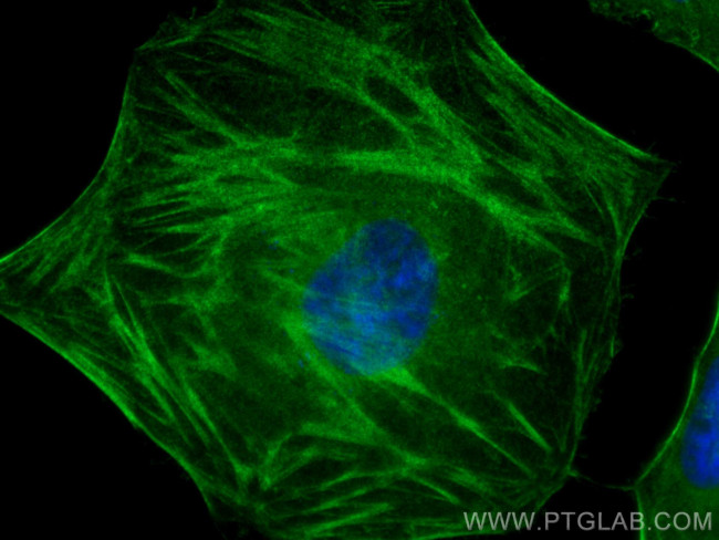 CALD1 Antibody in Immunocytochemistry (ICC/IF)