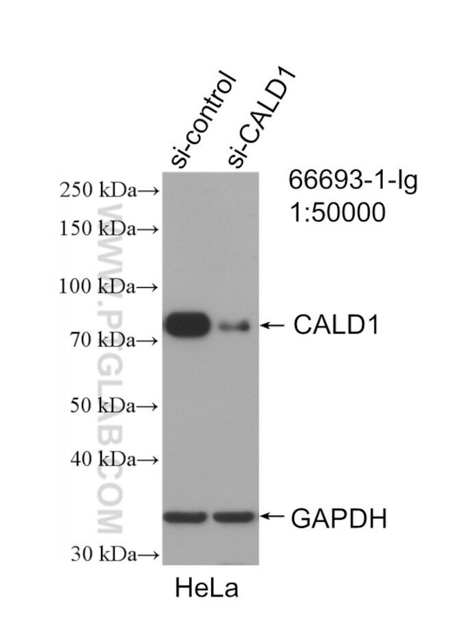 CALD1 Antibody in Western Blot (WB)