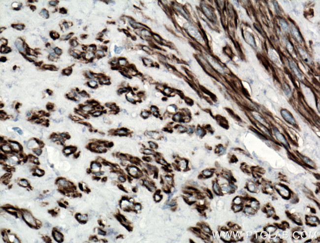 CALD1 Antibody in Immunohistochemistry (Paraffin) (IHC (P))