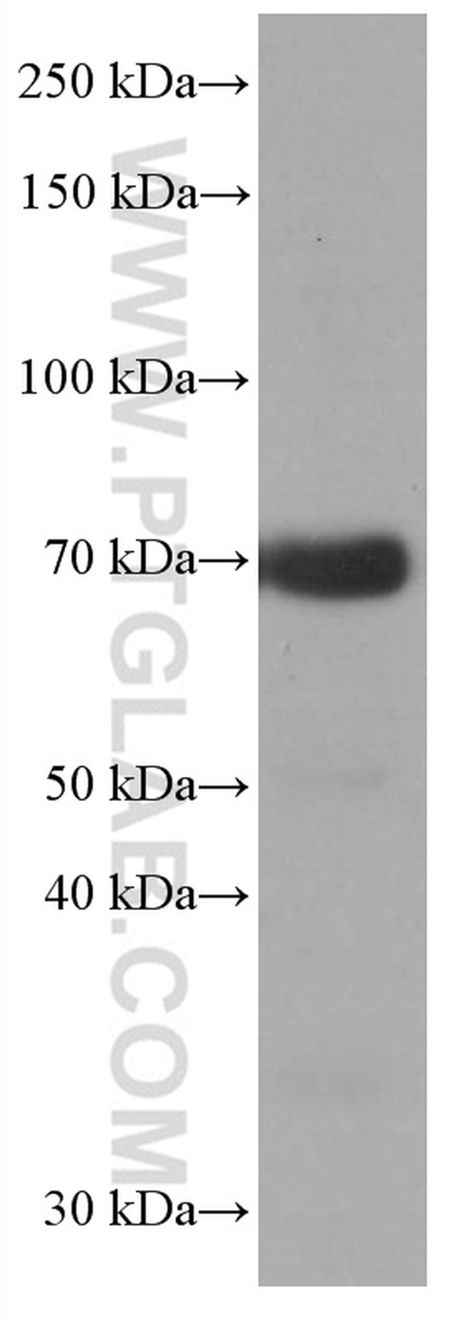 CALD1 Antibody in Western Blot (WB)