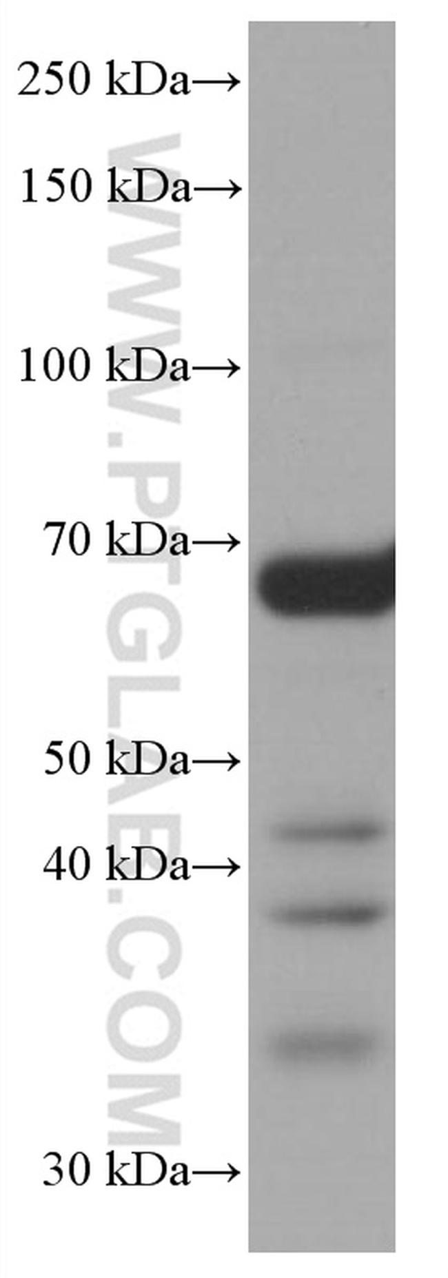 CALD1 Antibody in Western Blot (WB)