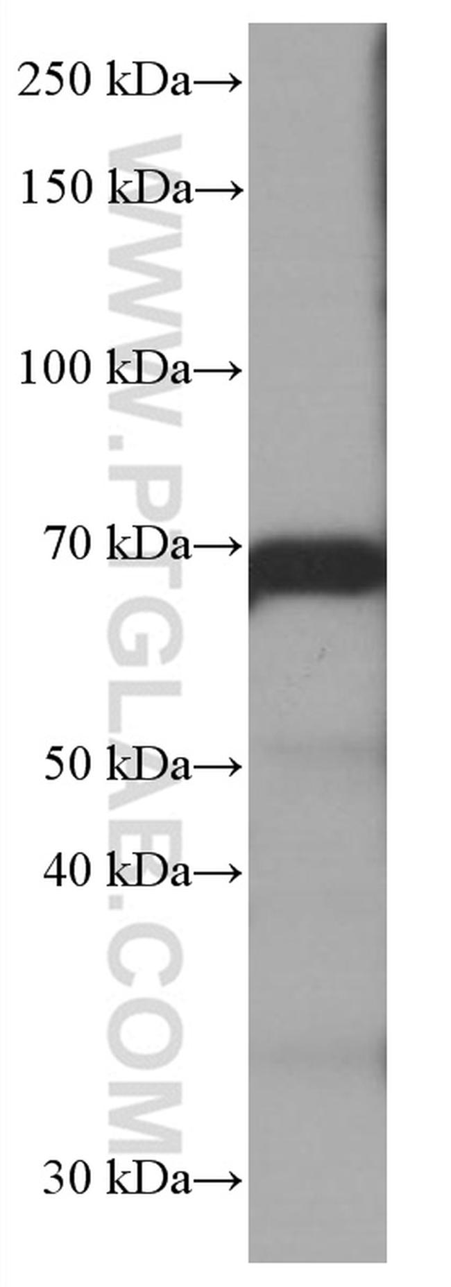 CALD1 Antibody in Western Blot (WB)