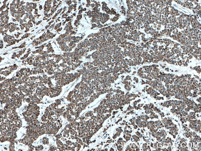 ATP5O Antibody in Immunohistochemistry (Paraffin) (IHC (P))