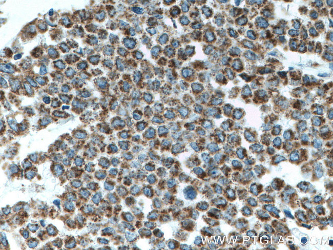 ATP5O Antibody in Immunohistochemistry (Paraffin) (IHC (P))