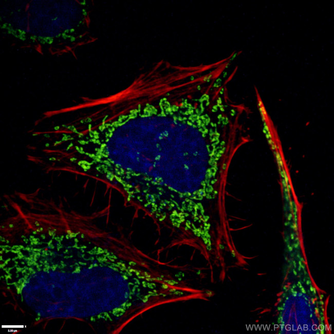 ATP5O Antibody in Immunocytochemistry (ICC/IF)