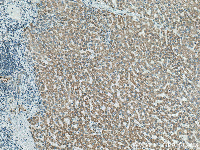 ATP5O Antibody in Immunohistochemistry (Paraffin) (IHC (P))