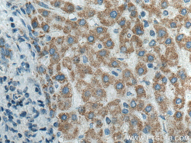 ATP5O Antibody in Immunohistochemistry (Paraffin) (IHC (P))