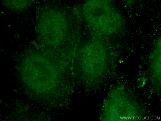 LIG4 Antibody in Immunocytochemistry (ICC/IF)