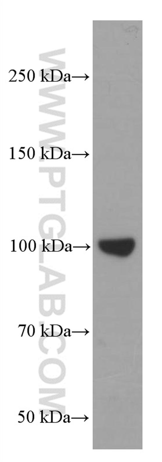 LIG4 Antibody in Western Blot (WB)