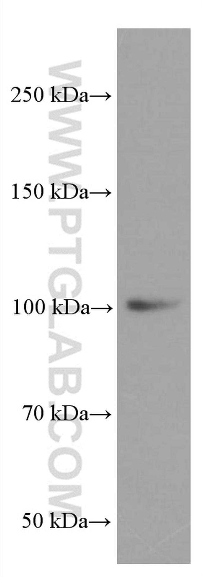 LIG4 Antibody in Western Blot (WB)