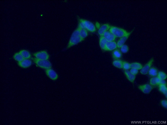 KIAA0652 Antibody in Immunocytochemistry (ICC/IF)