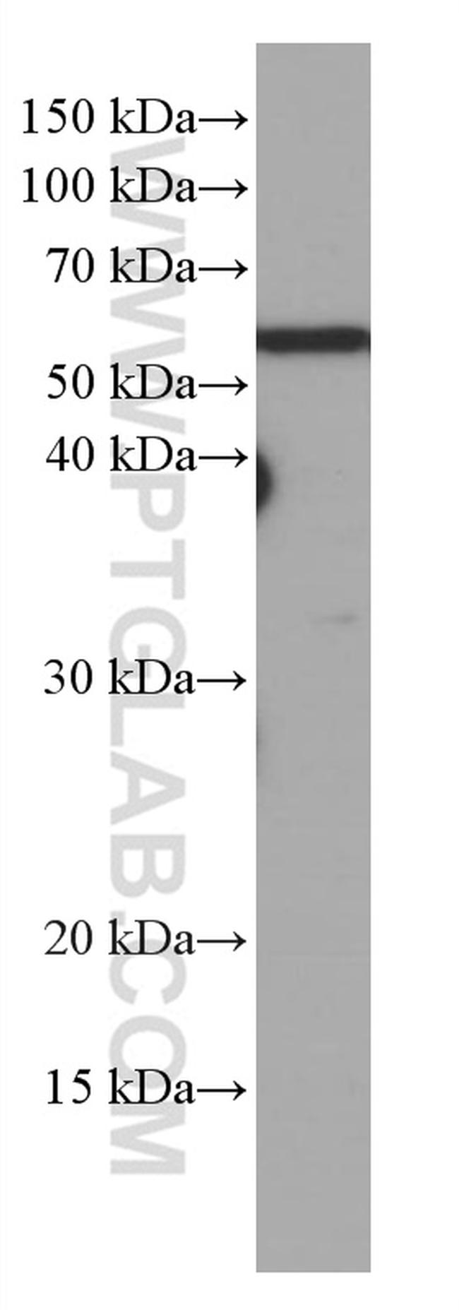 KIAA0652 Antibody in Western Blot (WB)