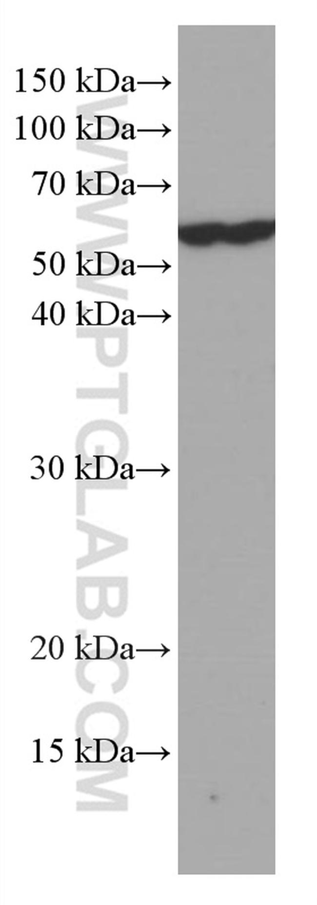 KIAA0652 Antibody in Western Blot (WB)