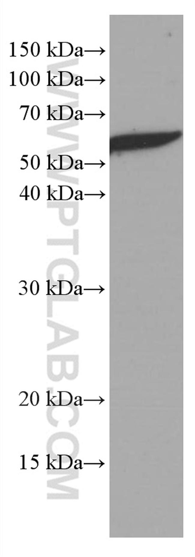 KIAA0652 Antibody in Western Blot (WB)