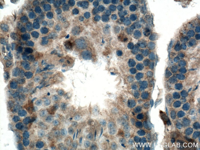 KIAA0652 Antibody in Immunohistochemistry (Paraffin) (IHC (P))